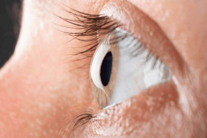 Βέλγος ασθενής με κερατόκωνο επέλεξε την Ελλάδα για την πρωτοποριακή επέμβαση με laser από τον Δρ Αναστάσιο-Ι. Κανελλόπουλο.