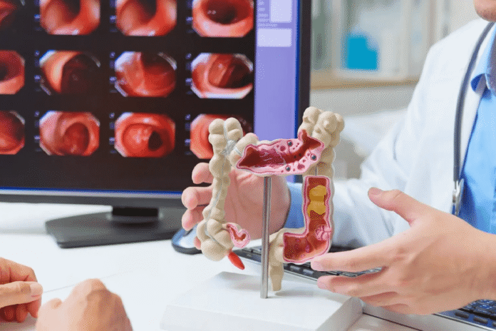 Ποια είναι τα πρώτα συμπτώματα του καρκίνου του παχέος εντέρου και πότε πρέπει να απευθυνθείτε στον γιατρό για έγκαιρη διάγνωση και θεραπεία.