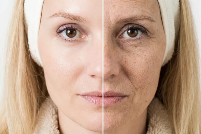 Πότε αρχίζει η απώλεια κολλαγόνου και πώς μπορείτε να την επιβραδύνετε με διατροφή, συμπληρώματα και σύγχρονες θεραπείες.