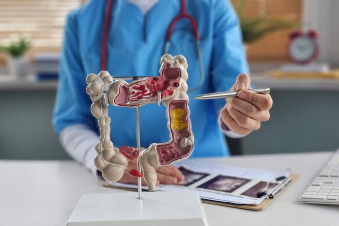 Αυξάνεται ο καρκίνος παχέος εντέρου σε άτομα κάτω των 50. Αιτίες, συμπτώματα και η σημασία της έγκαιρης διάγνωσης.